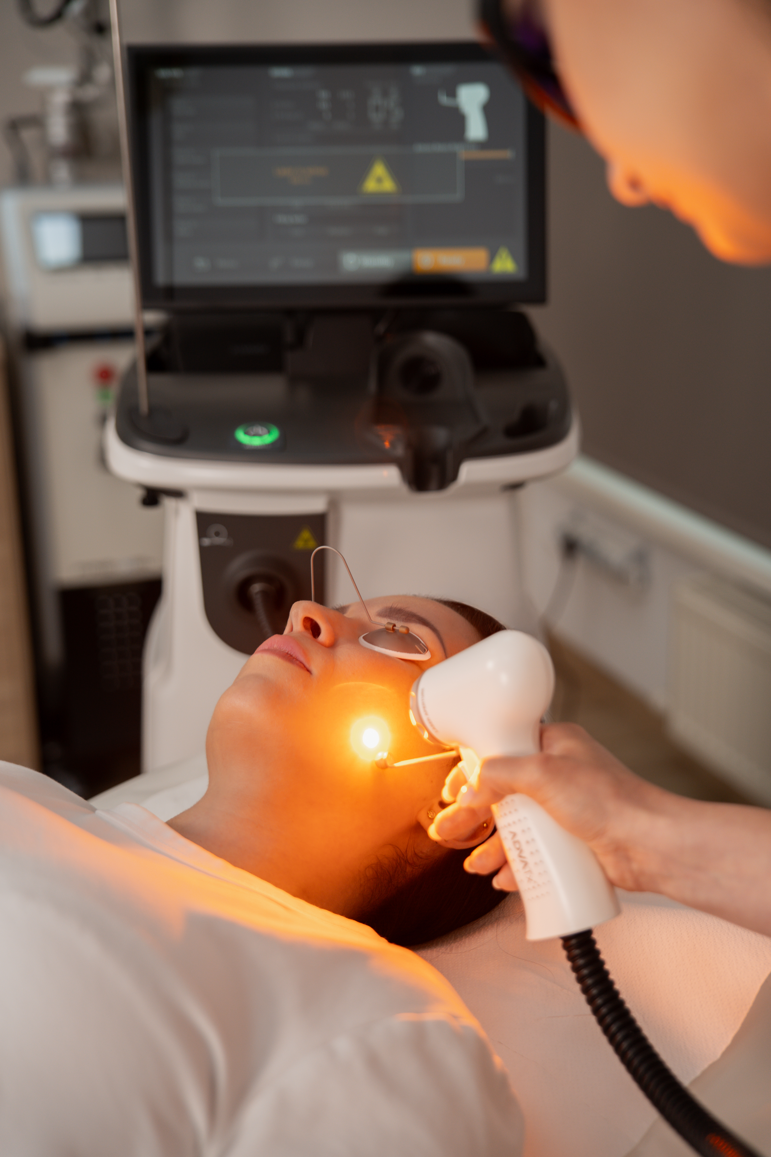 ADVATx Žilina: Špičkový laser na akné, rosaceu a cievky